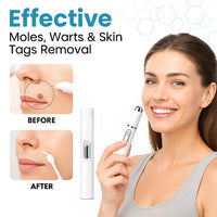 MediLazer Skin Pen