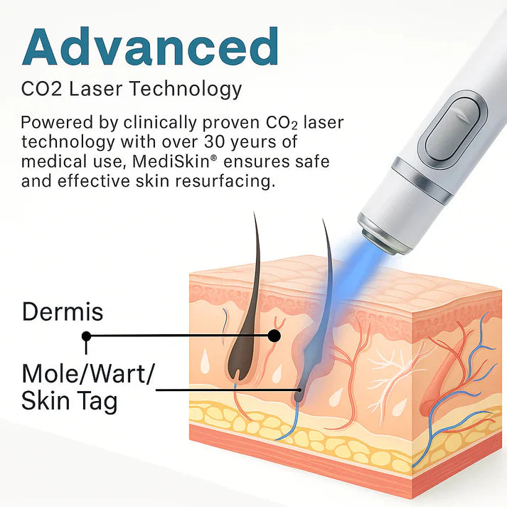 MediLazer Skin Pen