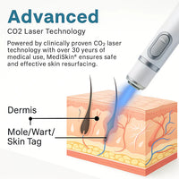 MediLazer Skin Pen
